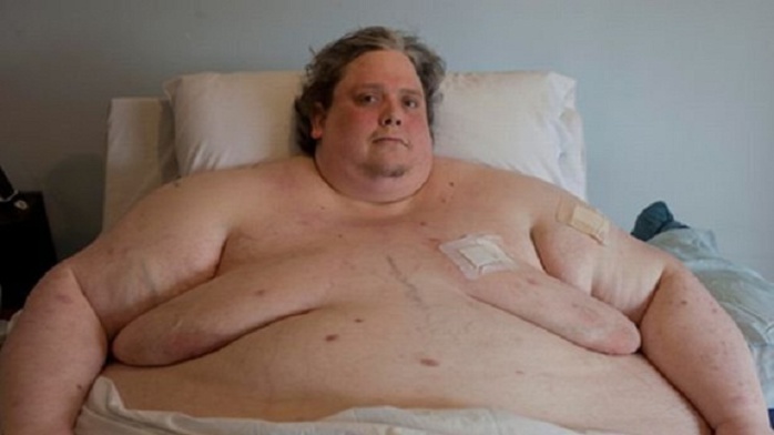 Keith Martin: L'homme le plus gros du monde est mort(Photos) Keith Martin: L'homme le plus gros du monde est mort(Photos)