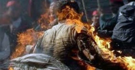 Fatick : Plaqué par sa copine, Abdou Faye tente de s'immoler par le feu