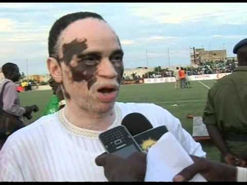 Réintégration de l’Uso : Mbaye Diouf Dia parle de "négligences coupables"