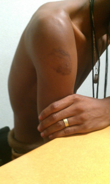 Menacé d’expulsion, l'Homosexuel sénégalais a été libéré par le tribunal administratif