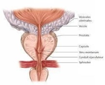 Les maladies de la prostate représentent 40 % des services de l’urologie