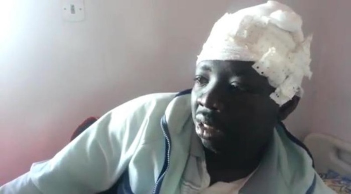 Horizon sans frontières dénonce l’agression de 2 sénégalais : « Le Maroc est devenu une terre de torture des migrants » Horizon sans frontières dénonce l’agression de 2 sénégalais : « Le Maroc est devenu une terre de torture des migrants »