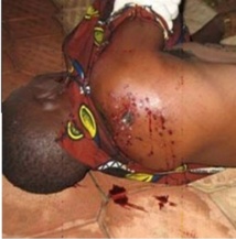 Oulampane : L'armée promet toute la lumière sur les élèves blessés par balles réelles Oulampane : L'armée promet toute la lumière sur les élèves blessés par balles réelles