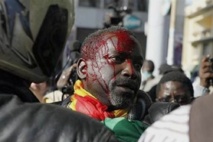 Violences : Le sang a encore coulé à Keur Massar Violences : Le sang a encore coulé à Keur Massar