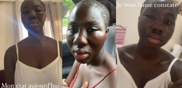 “Population malveillante, État inconscient”, “Suicide” : Le réquisitoire accablant de Adji Thiaré Diaw contre la société sénégalaise