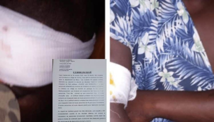 AFFAIRE TCHIKY : LE PROCUREUR DE MBOUR DÉVOILE LE RAPPORT D’ENQUÊTE