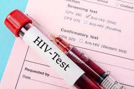 Diourbel: 12 patients atteints du VIH/Sida perdus de vue
