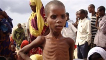 Somalie : la malnutrition succède à la famine et ses 250 000 morts Somalie : la malnutrition succède à la famine et ses 250 000 morts