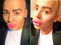 Le fan/sosie raté de Kim Kardashian est terrifié à l’idée que ses lèvres dégonflent Le fan/sosie raté de Kim Kardashian est terrifié à l’idée que ses lèvres dégonflent