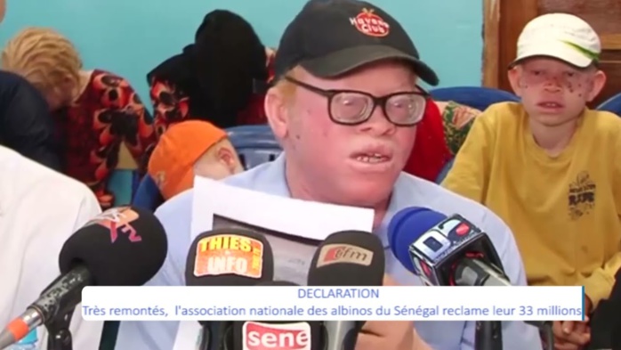 Le président de l’association nationale des albinos détourne 33 millions F CFA Le président de l’association nationale des albinos détourne 33 millions F CFA