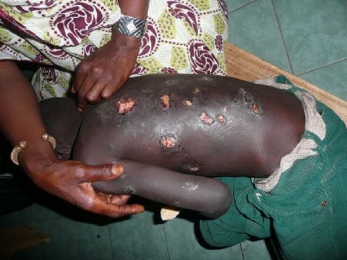 Un  élève  battu à mort par son maître coranique  à Yeumbeul-Nord