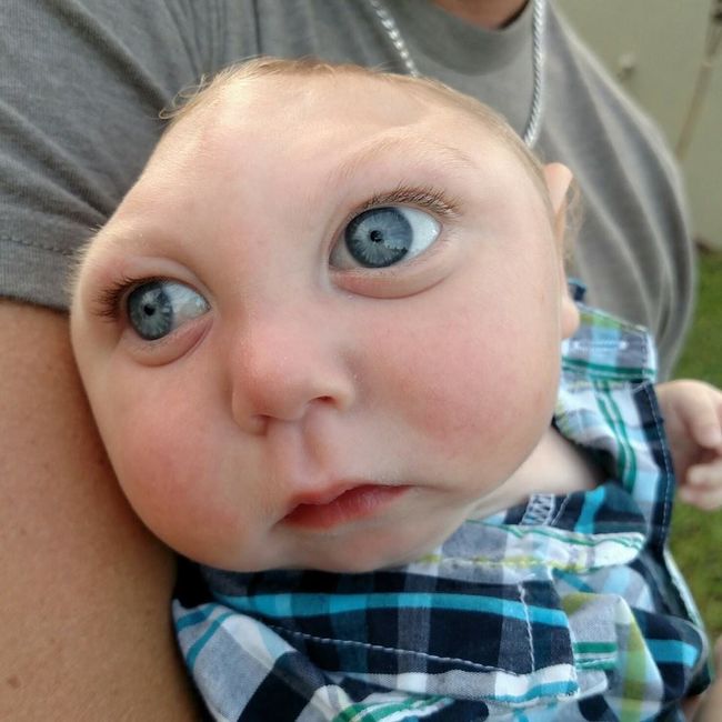 Miracle aux États-Unis : un bébé atteint ...,défie les pronostics des médecins(photos)