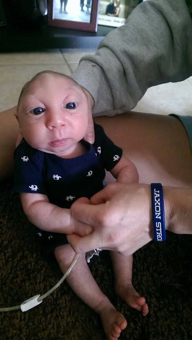 Miracle aux États-Unis : un bébé atteint ...,défie les pronostics des médecins(photos)