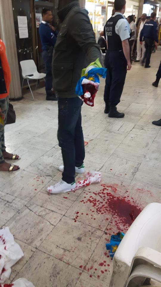 Belgique : Une sénégalaise arrêtée à Bruxelles après avoir tranché la main de son fiancé