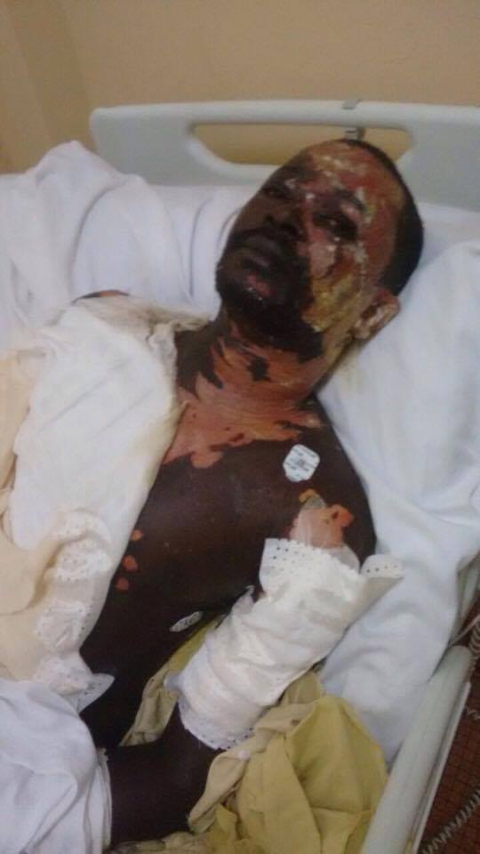 Ndèye Diallo verse de l'huile chaude sur son mari et s'enfuie