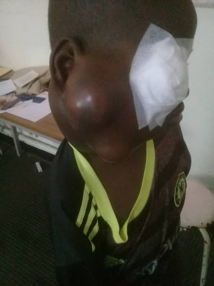 Cri du cœur d'une mère éplorée : "Mon enfant a un cancer et souffre terriblement !" (Diatou Fall)