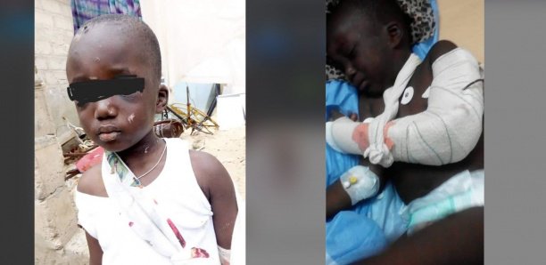 Torture à Mbour : Une femme casse le bras de son beau-fils, âgé de 5 ans