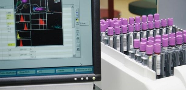 Coronavirus: Moscou a produit un premier lot de vaccin