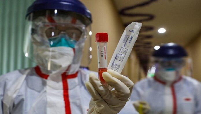 Covid-19: Les Tests de Diagnostic rapide (Tdr) désormais disponibles à 1525 F CFA l'unité