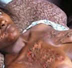 Pour une banale histoire de chargeur de téléphone : Diodio Dramé ébouillante Mariama Dramé