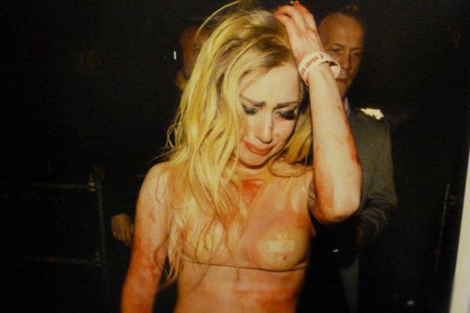 Lady Gaga malade, contrainte d'annuler des concerts