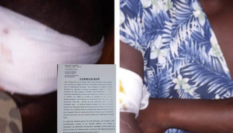 AFFAIRE TCHIKY : LE PROCUREUR DE MBOUR DÉVOILE LE RAPPORT D’ENQUÊTE