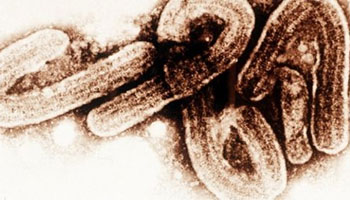 Ebola : plus de 100 cas recensés en trois jours en Afrique de l'Ouest santé
