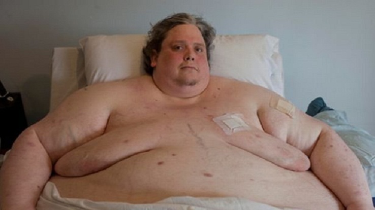 Keith Martin: L’homme le plus gros du monde est mort(Photos)