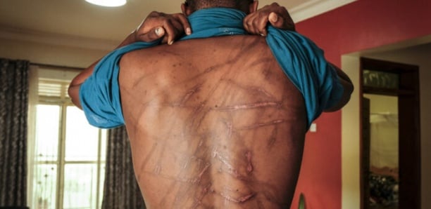 Actes de torture sur un détenu à Ziguinchor : La société civile s'en mêle