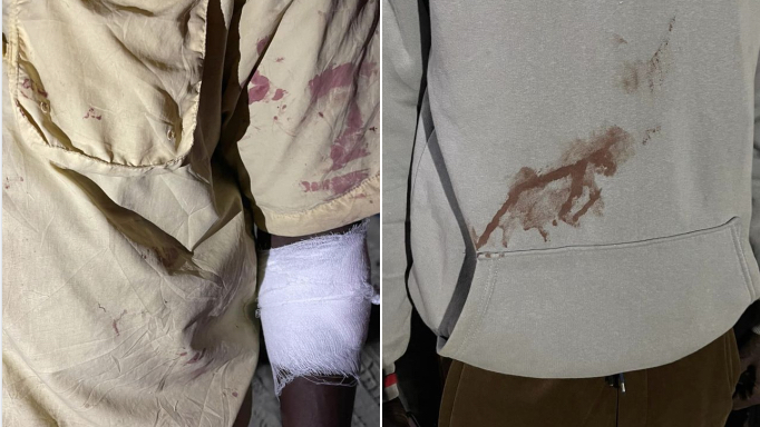 Diomaye Président victime d’une nouvelle attaque lors d’un cortège des « femmes linguères » (Photos)