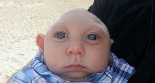 Miracle aux États-Unis : un bébé atteint ...,défie les pronostics des médecins(photos)