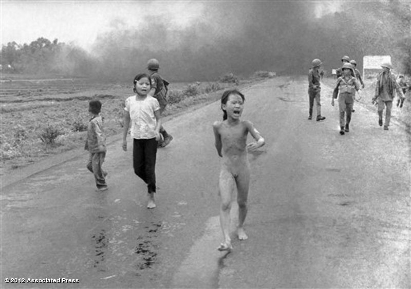43 ans après, la petite fille vietnamienne brûlée au napalm tente de soigner ses blessures au laser