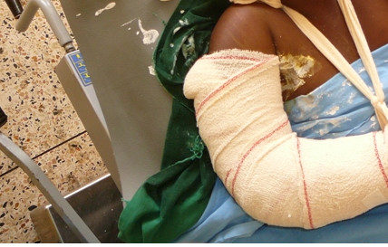 MBACKE - Un maire fracture l’avant-bras de sa première épouse