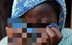 Kébémer: Une femme défigure sa co-épouse avec de l’acide