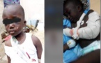 Torture à Mbour : Une femme casse le bras de son beau-fils, âgé de 5 ans
