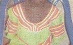 Le calvaire Thiouba Basse, une fille amputée des deux bras