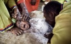 Crimes rituels, le prix du Sang au Gabon : 24 assassinats recensés depuis janvier 2013