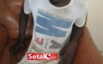 Sawrou Ndiaye  agressé par son épouse « Mon épouse m’a sectionné une partie du gland »