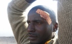 Les preuves du mauvais traitement reçu par le "Y en mariste" Latif Gomis. Il vient d’être libéré