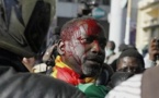 Violences : Le sang a encore coulé à Keur Massar