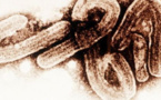 Ebola : plus de 100 cas recensés en trois jours en Afrique de l'Ouest santé