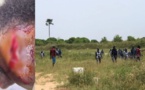 Litige foncier : Affrontements entre forces de sécurité et populations, des blessés graves à Mbeye