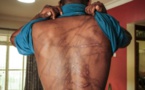 Actes de torture sur un détenu à Ziguinchor : La société civile s'en mêle