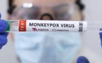 Variole du singe : La Guinée enregistre son premier cas