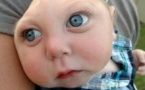Miracle aux États-Unis : un bébé atteint ...,défie les pronostics des médecins(photos)