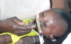 Moins de 20%  des enfants vivants avec  le VIH bénéficie D’Arv (ONUSIDA)