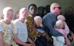 Horreur - Arrestation de dix Malawites soupçonnés du meurtre d’une Albinos