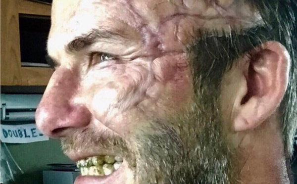 Qu'est-il arrivé à David Beckham? David Beckham a posté une photo de lui balafré sur Instagram.