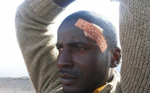 Les preuves du mauvais traitement reçu par le "Y en mariste" Latif Gomis. Il vient d’être libéré