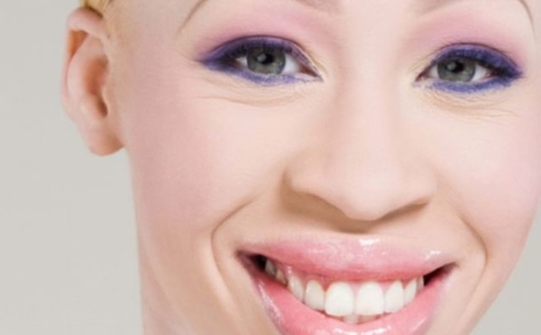 Miss Albinos débarque en Cote d’Ivoire
